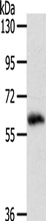 Rabbit Polyclonal Antibody to SRC