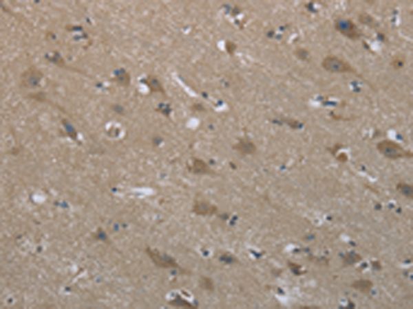 Rabbit Polyclonal Antibody to SYT3