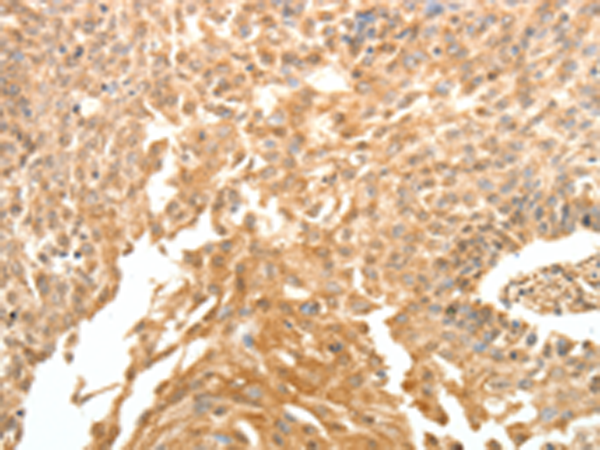 Rabbit Polyclonal Antibody to SYT6