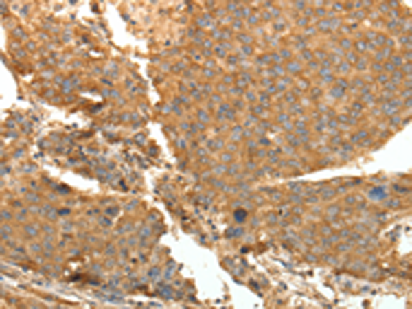 Rabbit Polyclonal Antibody to SYT11