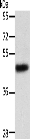 Rabbit Polyclonal Antibody to SPATA17