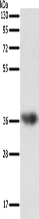 Rabbit Polyclonal Antibody to SULT1E1