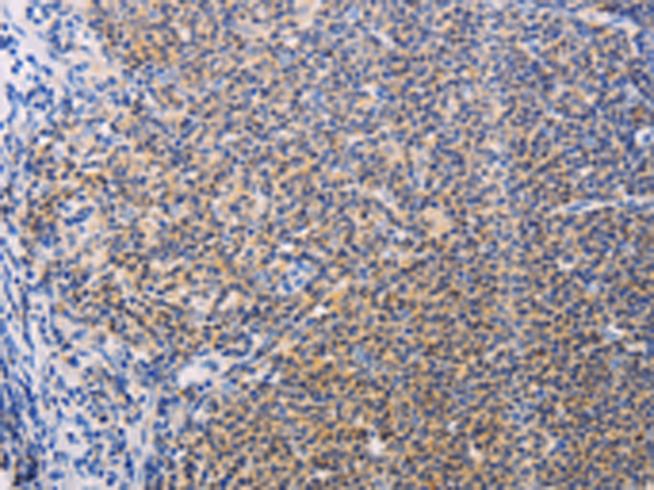 Rabbit Polyclonal Antibody to SYK