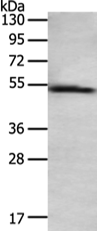 Rabbit Polyclonal Antibody to TAT