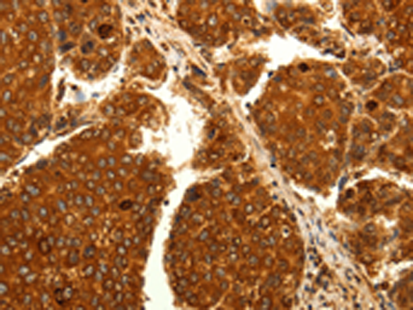 Rabbit Polyclonal Antibody to MAP1LC3A