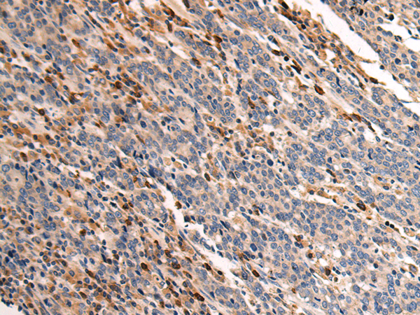 Rabbit Polyclonal Antibody to MAP3K9
