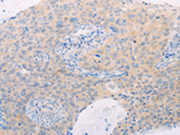 Rabbit Polyclonal Antibody to MAP3K12