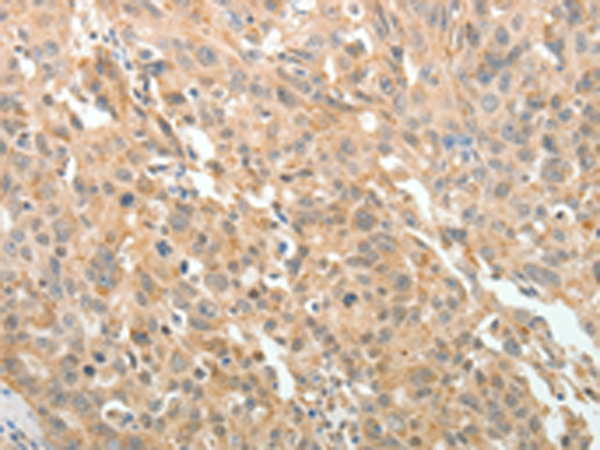 Rabbit Polyclonal Antibody to MAP4