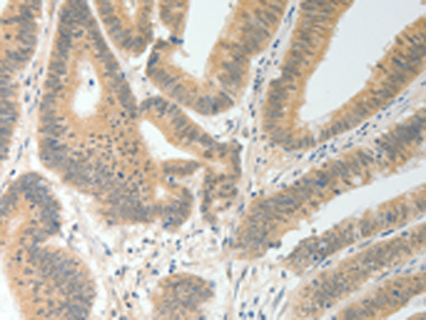 Rabbit Polyclonal Antibody to MAP4K5