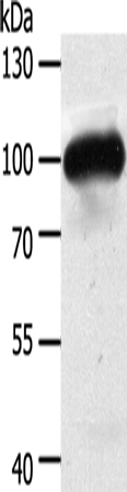 Rabbit Polyclonal Antibody to MAP4K3