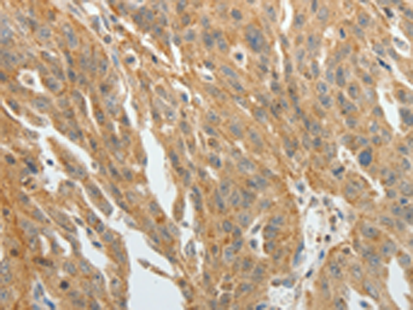 Rabbit Polyclonal Antibody to F3
