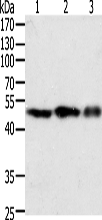 Rabbit Polyclonal Antibody to F7