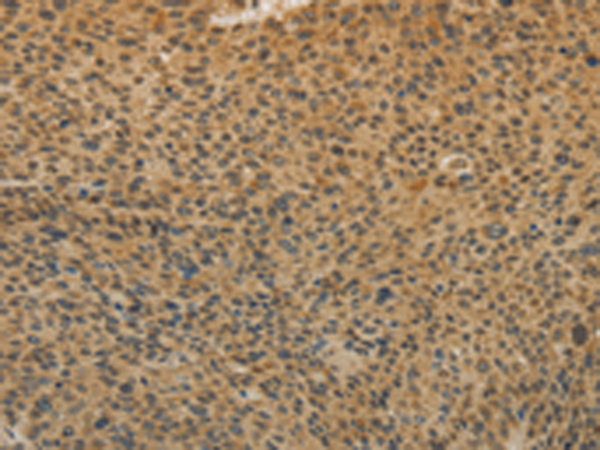 Rabbit Polyclonal Antibody to TGFB1