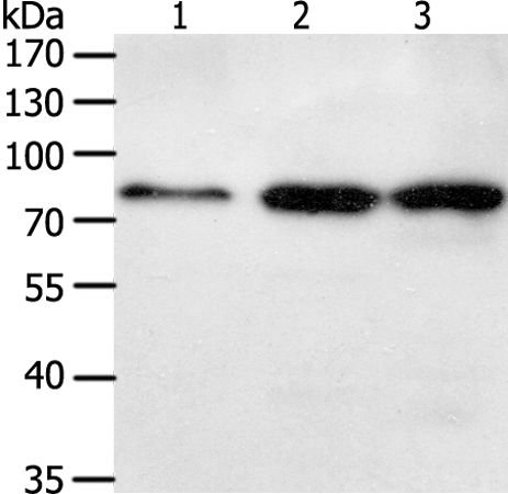Rabbit Polyclonal Antibody to TGM2