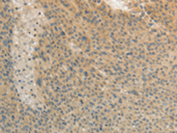 Rabbit Polyclonal Antibody to TEKT3