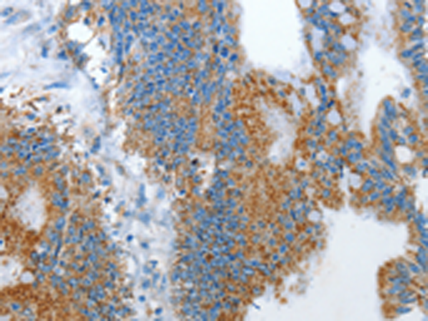 Rabbit Polyclonal Antibody to PLAAT4