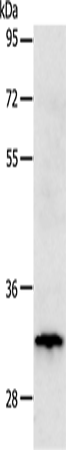 Rabbit Polyclonal Antibody to TIMP3