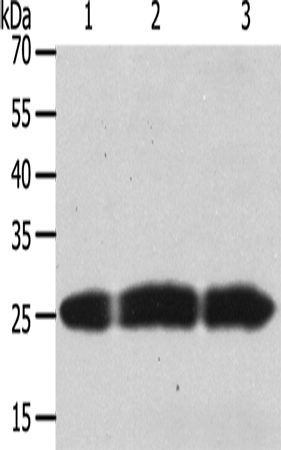 Rabbit Polyclonal Antibody to TIMP4