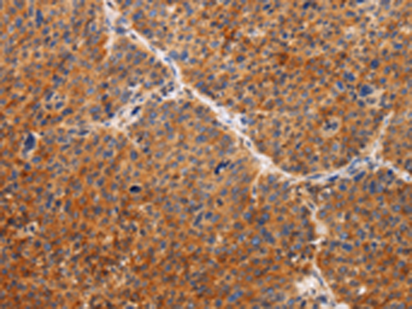 Rabbit Polyclonal Antibody to TIMP2