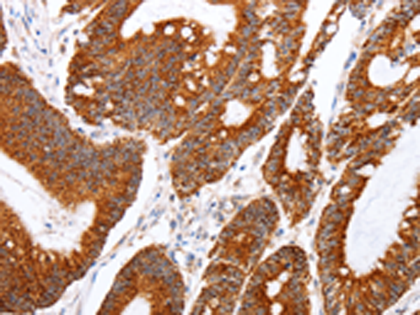 Rabbit Polyclonal Antibody to TNFAIP1