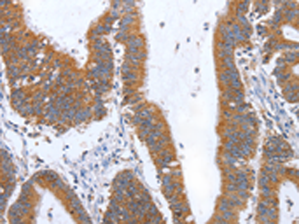 Rabbit Polyclonal Antibody to TNF