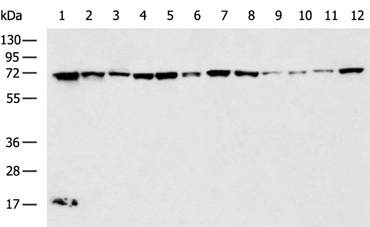 Rabbit Polyclonal Antibody to TNFRSF1B