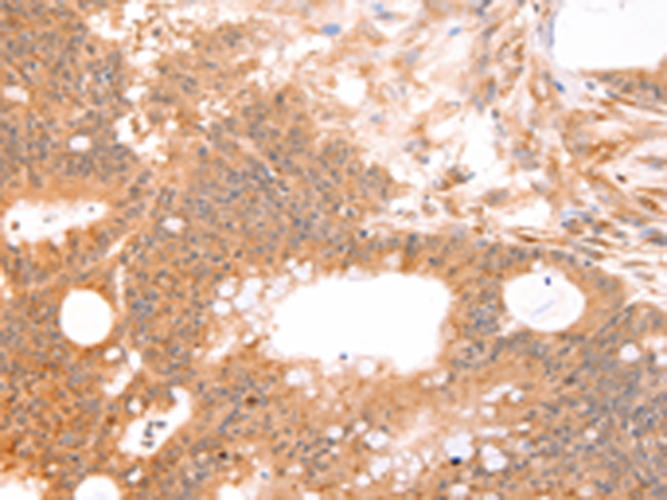 Rabbit Polyclonal Antibody to LTA