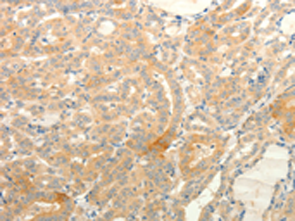 Rabbit Polyclonal Antibody to TPH1