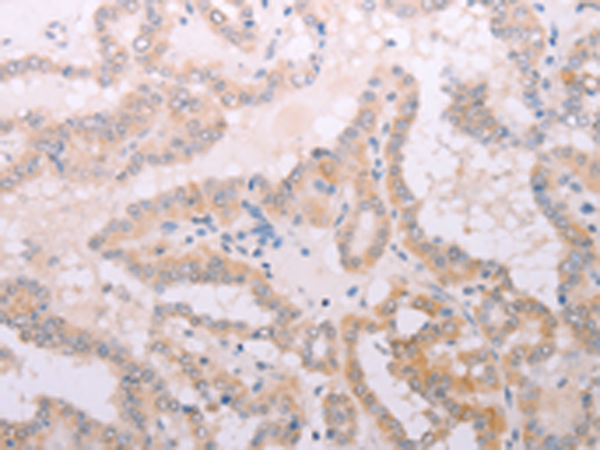 Rabbit Polyclonal Antibody to TPO