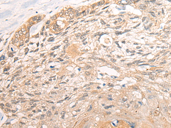 Rabbit Polyclonal Antibody to NR2C2AP