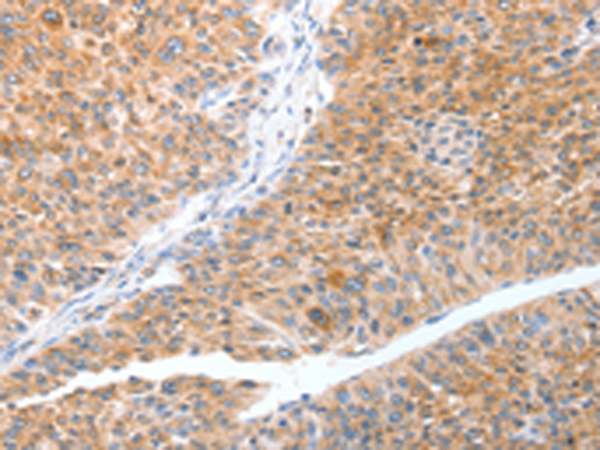 Rabbit Polyclonal Antibody to TRAF3IP3