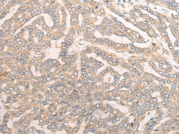 Rabbit Polyclonal Antibody to TRAF4