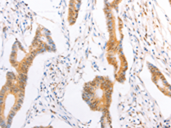 Rabbit Polyclonal Antibody to TRAF5