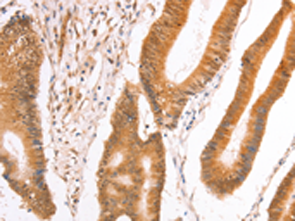 Rabbit Polyclonal Antibody to TAX1BP1