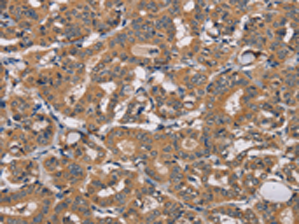 Rabbit Polyclonal Antibody to TRAFD1