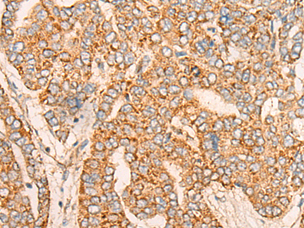 Rabbit Polyclonal Antibody to TNFSF10