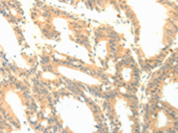 Rabbit Polyclonal Antibody to PTGES3