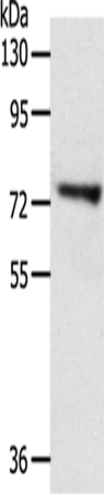 Rabbit Polyclonal Antibody to TRIM32