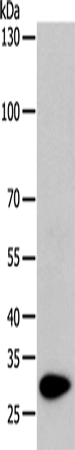 Rabbit Polyclonal Antibody to TPM1