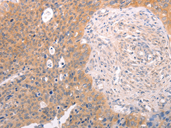 Rabbit Polyclonal Antibody to DCT