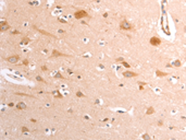 Rabbit Polyclonal Antibody to TRPV4