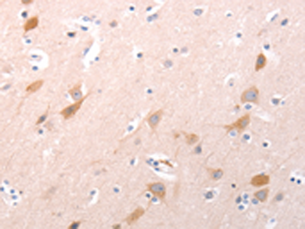 Rabbit Polyclonal Antibody to C1QTNF6