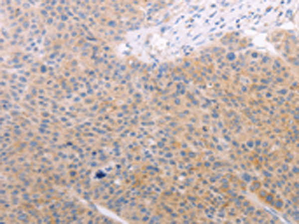 Rabbit Polyclonal Antibody to SPATA16
