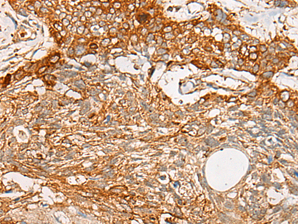 Rabbit Polyclonal Antibody to SPATA19
