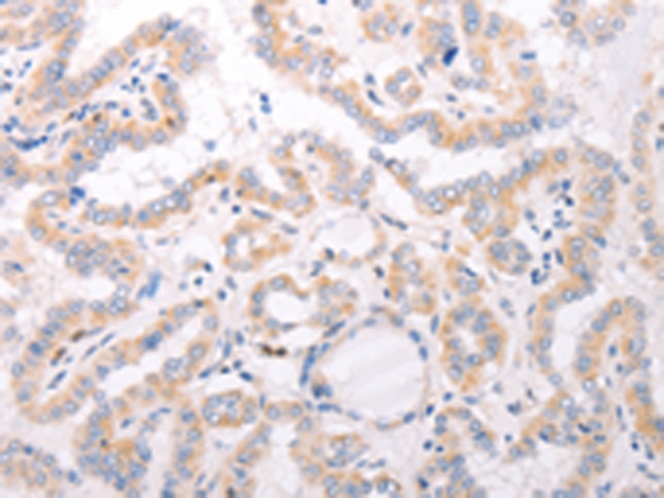Rabbit Polyclonal Antibody to CIDEB
