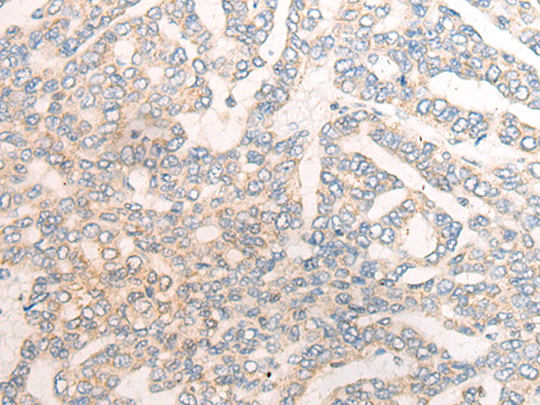 Rabbit Polyclonal Antibody to TSG101
