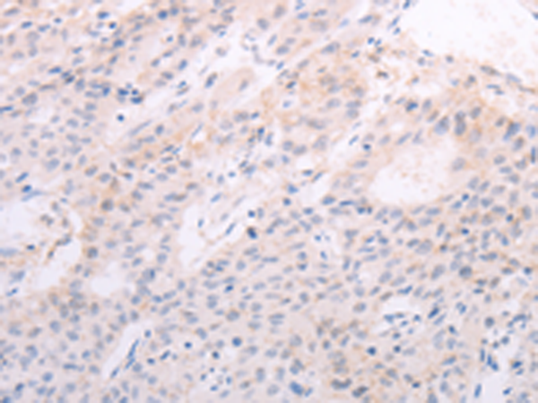 Rabbit Polyclonal Antibody to TSHR