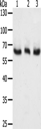 Rabbit Polyclonal Antibody to TYR