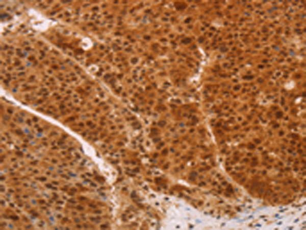 Rabbit Polyclonal Antibody to HEXIM1