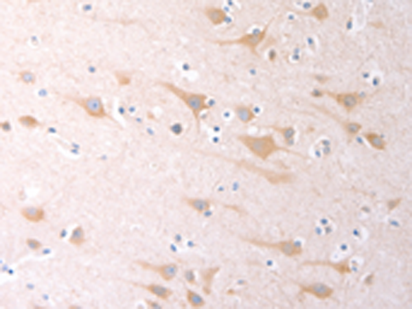 Rabbit Polyclonal Antibody to SCGB1A1